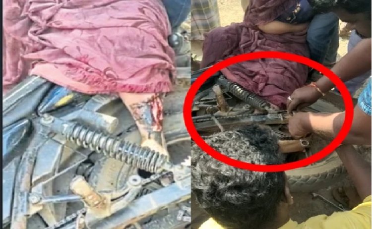 ಮಹಿಳೆಯರೇ ಎಚ್ಚರವಹಿಸಿ: ಸೀರೆ ಜೊತೆ ಬೈಕ್ ಚಕ್ರಕ್ಕೆ ಸಿಲುಕಿದ ಮಹಿಳೆಯ ಕಾಲು